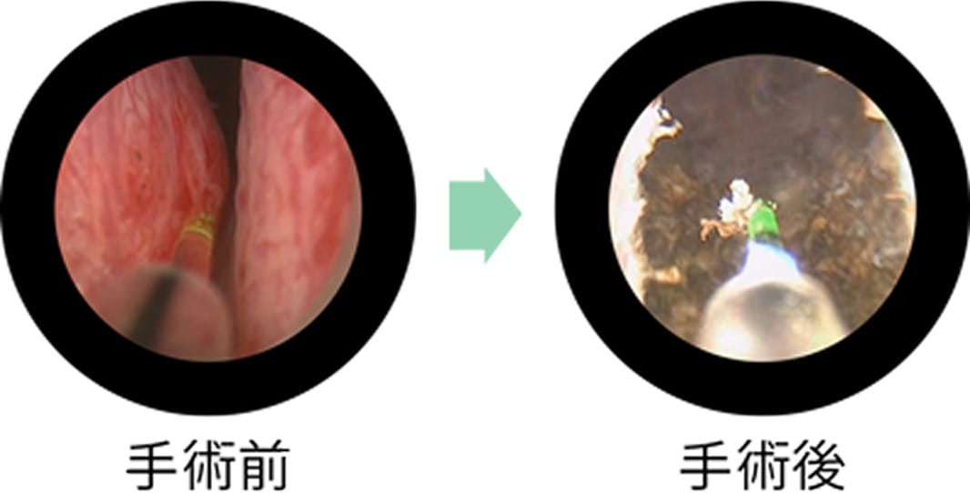 手術中の様子
