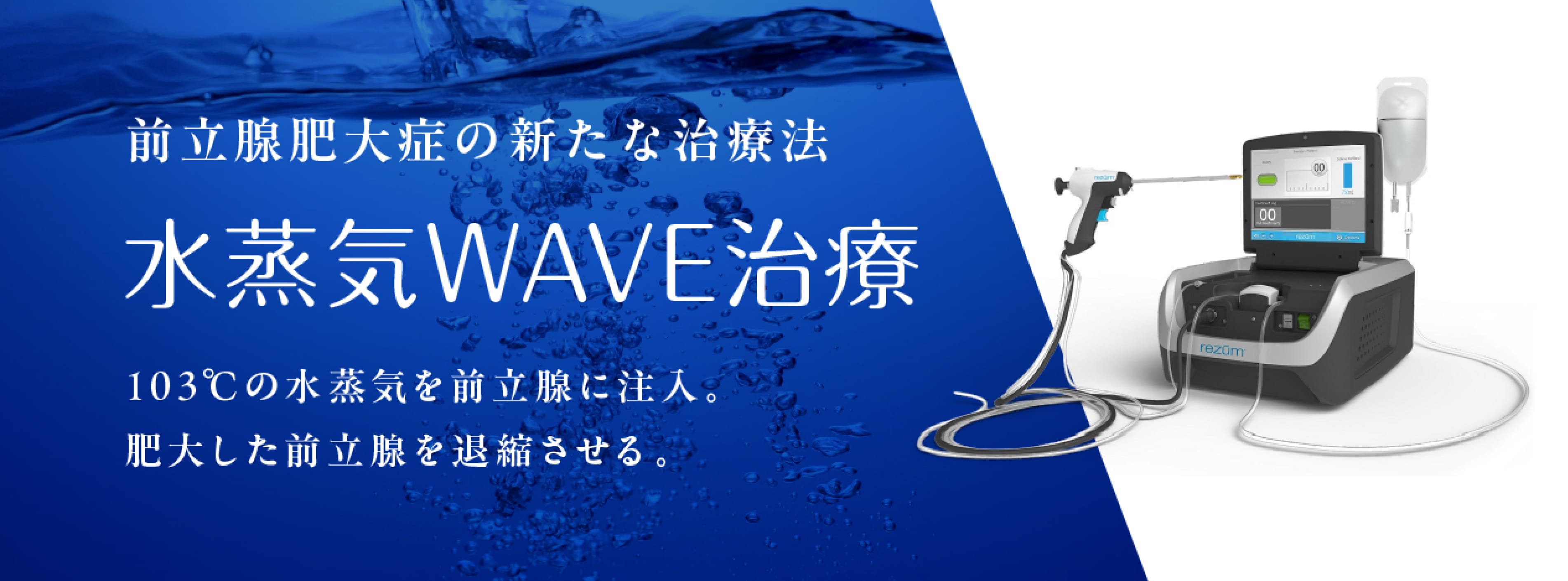 水蒸気WAVE治療のバナー